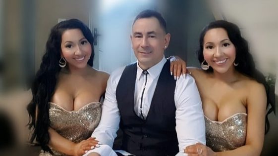 Meet Twins who had Cosmetic Surgeries to Look More Similar