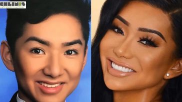 Nikita Dragun Plastic Surgery Journey — Before and After