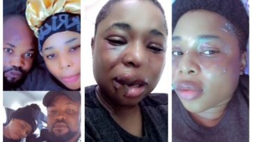 Lady who often shows off her boyfriend shares clip of her bruised face after alleged assault (Video)